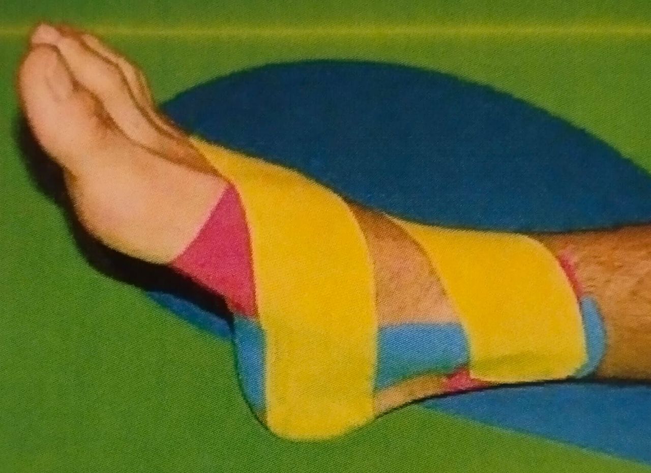 Ortesiología y vendajes vendaje neuromuscular3 msi jpeg 1280w